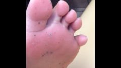 Rhea’s Starved Grimy Feet