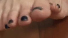 Korean Girl’s Black Toes Revealed